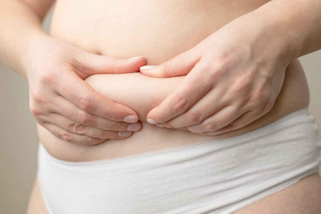 liposuction for belly fat or abdominal fat